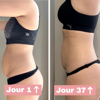 Sirolis : L'innovation anti-cellulite