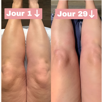 Sirolis : L'innovation anti-cellulite